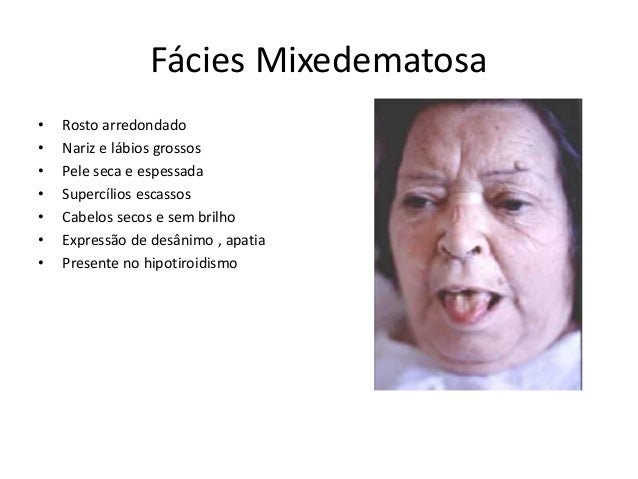 exame-neurol-gico