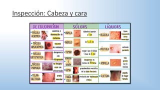 Inspección: Cabeza y cara
 