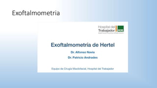 Exoftalmometria
 