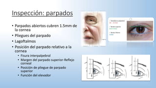 Inspección: parpados
• Parpados abiertos cubren 1.5mm de
la cornea
• Pliegues del parpado
• Lagoftalmos
• Posición del parpado relativo a la
cornea
• Fisura interpalpebral
• Margen del parpado superior-Reflejo
corneal
• Posición de pliegue de parpado
superior
• Función del elevador
 
