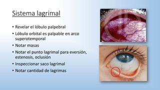 Sistema lagrimal
• Revelar el lóbulo palpebral
• Lóbulo orbital es palpable en arco
superotemporal
• Notar masas
• Notar el punto lagrimal para eversión,
estenosis, oclusión
• Inspeccionar saco lagrimal
• Notar cantidad de lagrimas
 
