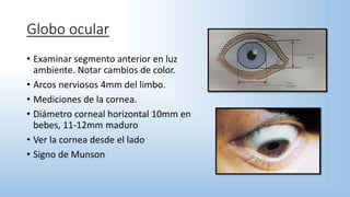 Globo ocular
• Examinar segmento anterior en luz
ambiente. Notar cambios de color.
• Arcos nerviosos 4mm del limbo.
• Mediciones de la cornea.
• Diámetro corneal horizontal 10mm en
bebes, 11-12mm maduro
• Ver la cornea desde el lado
• Signo de Munson
 
