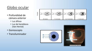 Globo ocular
• Profundidad de
cámara anterior
• Luz difusa
• Luz de hendidura
(Van Herick)
• Gonioscopio
• Transiluminador
 