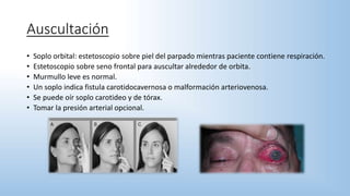 Auscultación
• Soplo orbital: estetoscopio sobre piel del parpado mientras paciente contiene respiración.
• Estetoscopio sobre seno frontal para auscultar alrededor de orbita.
• Murmullo leve es normal.
• Un soplo indica fistula carotidocavernosa o malformación arteriovenosa.
• Se puede oír soplo carotideo y de tórax.
• Tomar la presión arterial opcional.
 