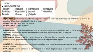 • PROQUELIA: En el análisis facial frontal se puede valorar el ancho de los labios para determinar si la boca es
grande o pequeña en relación al resto de la cara.
• NORMOQUELIA: Labio posición normal.
• RETROQUELIA: El labio hundido.
• HIPERTÓNICO: Es una disfunción oral que se caracteriza por una posición incorrecta de la lengua al tragar,
afectando al desarrollo normal de la dentición, el habla, la salud e incluso a la estética.
• NORMAL: Labio normal.
• HIPOTÓNICO: Alteraciones del habla, debido a la falta de fuerza muscular para articular correctamente
fonemas en los que interviene la lengua en caso de mala posición en reposo.
• GRUESO: Son voluminosos, con comisuras marcadas, pero con una contextura muscular gruesa que hace que
se vean grandes
• DELGADO: Es aquella en la que el labio inferior es el doble de grueso que el superior y debe ocupar un 10%
del tercio.
 