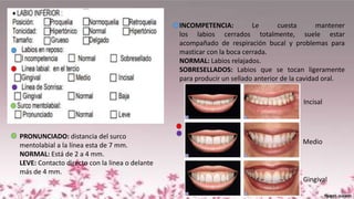 INCOMPETENCIA: Le cuesta mantener
los labios cerrados totalmente, suele estar
acompañado de respiración bucal y problemas para
masticar con la boca cerrada.
NORMAL: Labios relajados.
SOBRESELLADOS: Labios que se tocan ligeramente
para producir un sellado anterior de la cavidad oral.
Incisal
Medio
Gingival
PRONUNCIADO: distancia del surco
mentolabial a la línea esta de 7 mm.
NORMAL: Está de 2 a 4 mm.
LEVE: Contacto directo con la linea o delante
más de 4 mm.
 