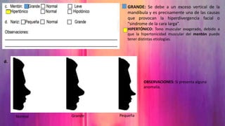 GRANDE: Se debe a un exceso vertical de la
mandíbula y es precisamente una de las causas
que provocan la hiperdivergencia facial o
“síndrome de la cara larga”.
HIPERTÓNICO: Tono muscular exagerado, debido a
que la hipertonicidad muscular del mentón puede
tener distintas etiologías.
Normal Grande Pequeña
OBSERVACIONES: Si presenta alguna
anomalía.
d.
 