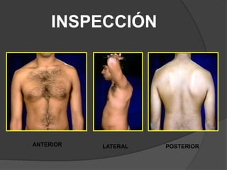 INSPECCIÓN
ANTERIOR LATERAL POSTERIOR
 