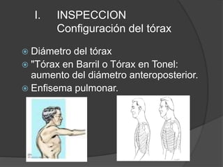 I. INSPECCION
Configuración del tórax
 Diámetro del tórax
 "Tórax en Barril o Tórax en Tonel:
aumento del diámetro anteroposterior.
 Enfisema pulmonar.
 