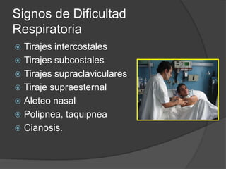 Signos de Dificultad
Respiratoria
 Tirajes intercostales
 Tirajes subcostales
 Tirajes supraclaviculares
 Tiraje supraesternal
 Aleteo nasal
 Polipnea, taquipnea
 Cianosis.
 