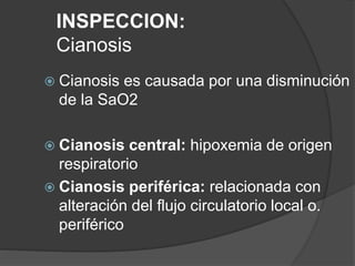 INSPECCION:
Cianosis
 Cianosis es causada por una disminución
de la SaO2
 Cianosis central: hipoxemia de origen
respiratorio
 Cianosis periférica: relacionada con
alteración del flujo circulatorio local o.
periférico
 