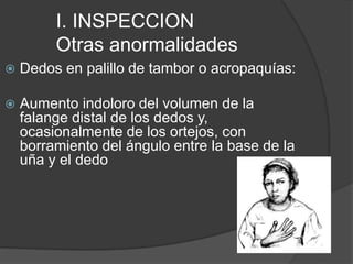 I. INSPECCION
Otras anormalidades
 Dedos en palillo de tambor o acropaquías:
 Aumento indoloro del volumen de la
falange distal de los dedos y,
ocasionalmente de los ortejos, con
borramiento del ángulo entre la base de la
uña y el dedo
 