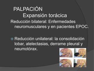 PALPACIÓN
Expansión torácica
Reducción bilateral: Enfermedades
neuromusculares y en pacientes EPOC.
 Reducción unilateral: la consolidación
lobar, atelectasias, derrame pleural y
neumotórax.
 