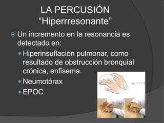 LA PERCUSIÓN
“Hiperrresonante”
 Un incremento en la resonancia es
detectado en:
 Hiperinsuflación pulmonar, como
resultado de obstrucción bronquial
crónica, enfisema.
 Neumotórax
 EPOC
 