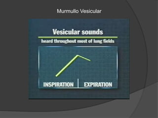 Murmullo Vesicular
 