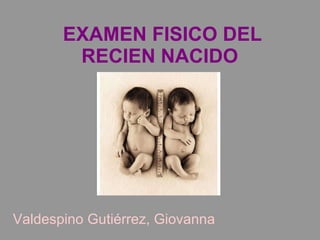 EXAMEN FISICO DEL RECIEN NACIDO  Valdespino Gutiérrez, Giovanna 