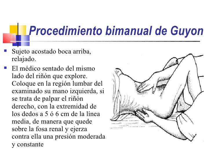 Los ejercicios necesarios físicos a la osteocondrosis