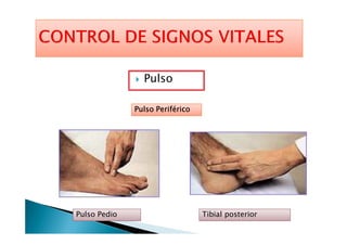 Pulso
Pulso PeriféricoPulso PeriféricoPulso PeriféricoPulso Periférico
Pulso Pedio Tibial posterior
 