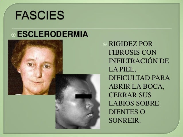 Cretina Significado Cretina Traduo Dicionrio