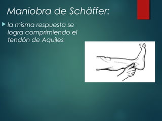 Maniobra de Schäffer:
 la misma respuesta se
logra comprimiendo el
tendón de Aquiles
 
