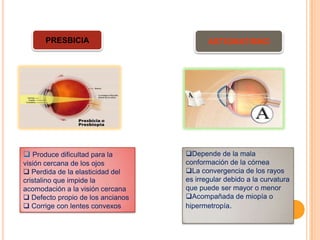 PRESBICIA

ASTIGMATISMO

 Produce dificultad para la

Depende de la mala
conformación de la córnea
La convergencia de los rayos
es irregular debido a la curvatura
que puede ser mayor o menor
Acompañada de miopía o
hipermetropía.

visión cercana de los ojos
 Perdida de la elasticidad del
cristalino que impide la
acomodación a la visión cercana
 Defecto propio de los ancianos
 Corrige con lentes convexos

 