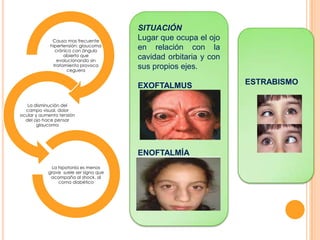 Causa mas frecuente
hipertensión: glaucoma
crónico con ángulo
abierto que
evolucionando sin
tratamiento provoca
ceguera

SITUACIÓN
Lugar que ocupa el ojo
en relación con la
cavidad orbitaria y con
sus propios ejes.

EXOFTALMUS
La disminución del
campo visual, dolor
ocular y aumento tensión
del ojo hace pensar
glaucoma

ENOFTALMÍA
La hipotonía es menos
grave suele ser signo que
acompaña al shock, al
coma diabético

ESTRABISMO

 