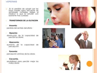 EPISTAXIS





Es la perdida de sangre por las
fosas nasales signo frecuente de
semiología compleja obliga al
medico a que la estudie con
bastante mas cuidado
TRANSTORNOS DE LA OLFACION

Anosmia:
perdida del sentido del olfato







Hiposmia:
disminución de la capacidad de
percibir los olores
Hiperosmia:
aumento de la
percepción

capacidad

de

Parosmia:
percepción errónea de los olores





Cacosmia.
sensibilidad para percibir mejor los
malos olores

 