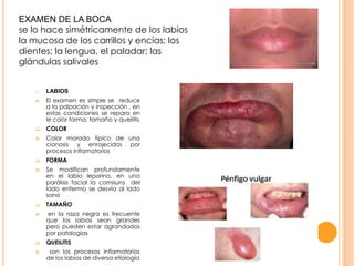 EXAMEN DE LA BOCA
se lo hace simétricamente de los labios
la mucosa de los carrillos y encías; los
dientes; la lengua, el paladar; las
glándulas salivales
















LABIOS
El examen es simple se reduce
a la palpación y inspección , en
estas condiciones se repara en
le color forma, tamaño y queilitis
COLOR
Color morado típico de una
cianosis y enrojecidos por
procesos inflamatorios
FORMA
Se modifican profundamente
en el labio leporino, en una
parálisis facial la comisura del
lado enfermo se desvía al lado
sano
TAMAÑO
en la raza negra es frecuente
que los labios sean grandes
pero pueden estar agrandados
por patologías
QUEILITIS
son los procesos inflamatorios
de los labios de diversa etiología

 