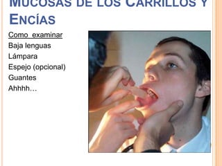MUCOSAS DE LOS CARRILLOS Y
ENCÍAS
Como examinar
Baja lenguas
Lámpara
Espejo (opcional)
Guantes
Ahhhh…

 