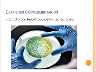 EXÁMENES COMPLEMENTARIOS


Estudio bacteriológico de las secreciones.

 