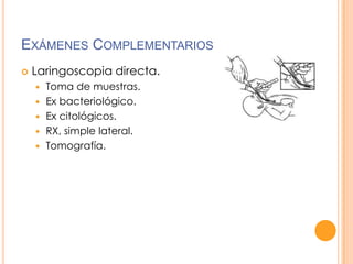 EXÁMENES COMPLEMENTARIOS


Laringoscopia directa.






Toma de muestras.
Ex bacteriológico.
Ex citológicos.
RX, simple lateral.
Tomografía.

 