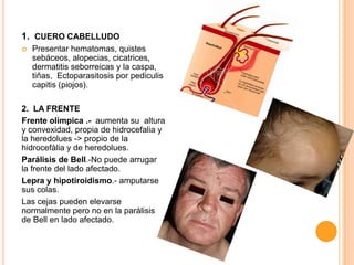 1. CUERO CABELLUDO


Presentar hematomas, quistes
sebáceos, alopecias, cicatrices,
dermatitis seborreicas y la caspa,
tiñas, Ectoparasitosis por pediculis
capitis (piojos).

2. LA FRENTE
Frente olímpica .- aumenta su altura
y convexidad, propia de hidrocefalia y
la heredolues -> propio de la
hidrocefàlia y de heredolues.
Parálisis de Bell.-No puede arrugar
la frente del lado afectado.
Lepra y hipotiroidismo.- amputarse
sus colas.
Las cejas pueden elevarse
normalmente pero no en la parálisis
de Bell en lado afectado.

 