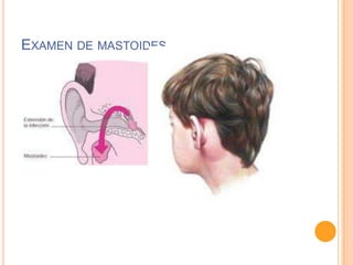 EXAMEN DE MASTOIDES

 
