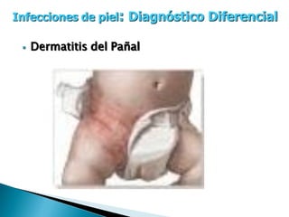  Micosis Superficiales
 5 a 10 % de consultas
 Dermatofitos, Candida y Malassezia .
 Ambiente y susceptibilidad del hu...