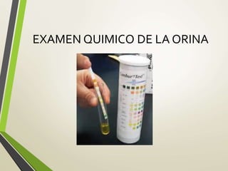 EXAMEN QUIMICO DE LA ORINA
 