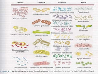 Examen general de orina