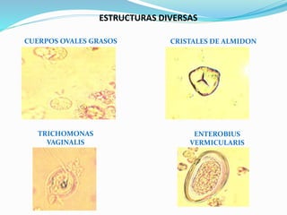 Examen general de orina | PPTX