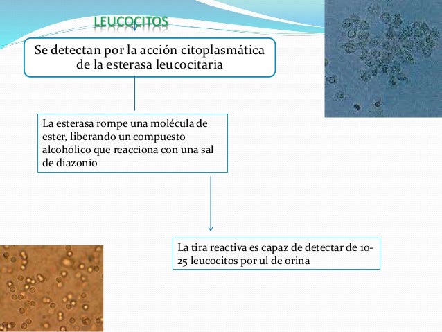 Examen general de orina