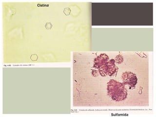 Cistina
Sulfamida
 