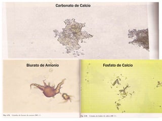 Carbonato de Calcio
Fosfato de Calcio
Biurato de Amonio
 
