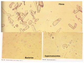 Fibras
Bacterias
Espermatozoides
 