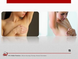 15
Dr. Cristian Francisco. Obstetra-Ginecólogo /Oncólogo. Docente Universitario.
 