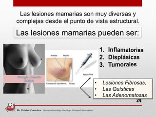 24
Las lesiones mamarias son muy diversas y
complejas desde el punto de vista estructural.
Las lesiones mamarias pueden ser:
Dr. Cristian Francisco. Obstetra-Ginecólogo /Oncólogo. Docente Universitario.
 