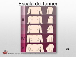 Escala de Tanner
26
Dr. Cristian Francisco. Obstetra-Ginecólogo /Oncólogo. Docente Universitario.
 