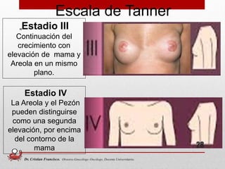 „Estadio III
Continuación del
crecimiento con
elevación de mama y
Areola en un mismo
plano.
Estadio IV
La Areola y el Pezón
pueden distinguirse
como una segunda
elevación, por encima
del contorno de la
mama
Escala de Tanner
28
Dr. Cristian Francisco. Obstetra-Ginecólogo /Oncólogo. Docente Universitario.
 