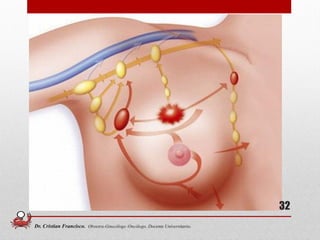32
Dr. Cristian Francisco. Obstetra-Ginecólogo /Oncólogo. Docente Universitario.
 