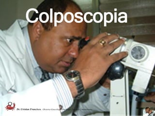 Colposcopia
44
Dr. Cristian Francisco. Obstetra-Ginecólogo /Oncólogo. Docente Universitario.
 