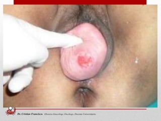 49
Dr. Cristian Francisco. Obstetra-Ginecólogo /Oncólogo. Docente Universitario.
 