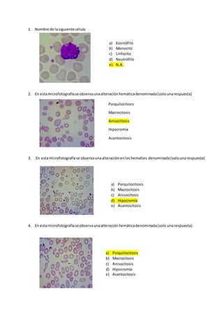 1. Nombre de lasiguiente célula
2. En estamicrofotografíase observaunaalteraciónhemáticadenominada(solounarespuesta)
3. En estamicrofotografíase observaunaalteración enloshematies denominada(solounarespuesta)
4. En estamicrofotografíase observaunaalteraciónhemáticadenominada(solo unarespuesta)
a) Eosinófilo
b) Monocito
c) Linfocito
d) Neutrófilo
e) N.A.
Poiquilocitosis
Macrocitosis
Anisocitosis
Hipocromía
Acantocitosis
a) Poiquilocitosis
b) Macrocitosis
c) Anisocitosis
d) Hipocromía
e) Acantocitosis
a) Poiquilocitosis
b) Macrocitosis
c) Anisocitosis
d) Hipocromía
e) Acantocitosis
 