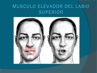 MUSCULO ELEVADOR DEL LABIOMUSCULO ELEVADOR DEL LABIO
SUPERIORSUPERIOR
 